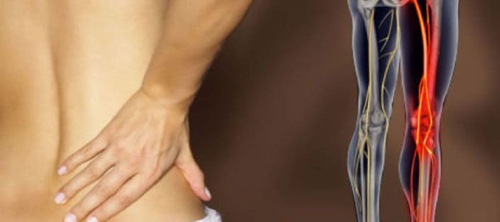 Help with sciatica and leg pain from Dr. Stepanie Louie Chiropractor Victoria BC